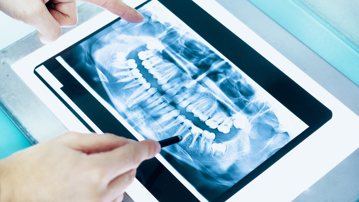 are dental x-rays necessary -